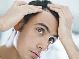 Hair-Transplant-Treatment